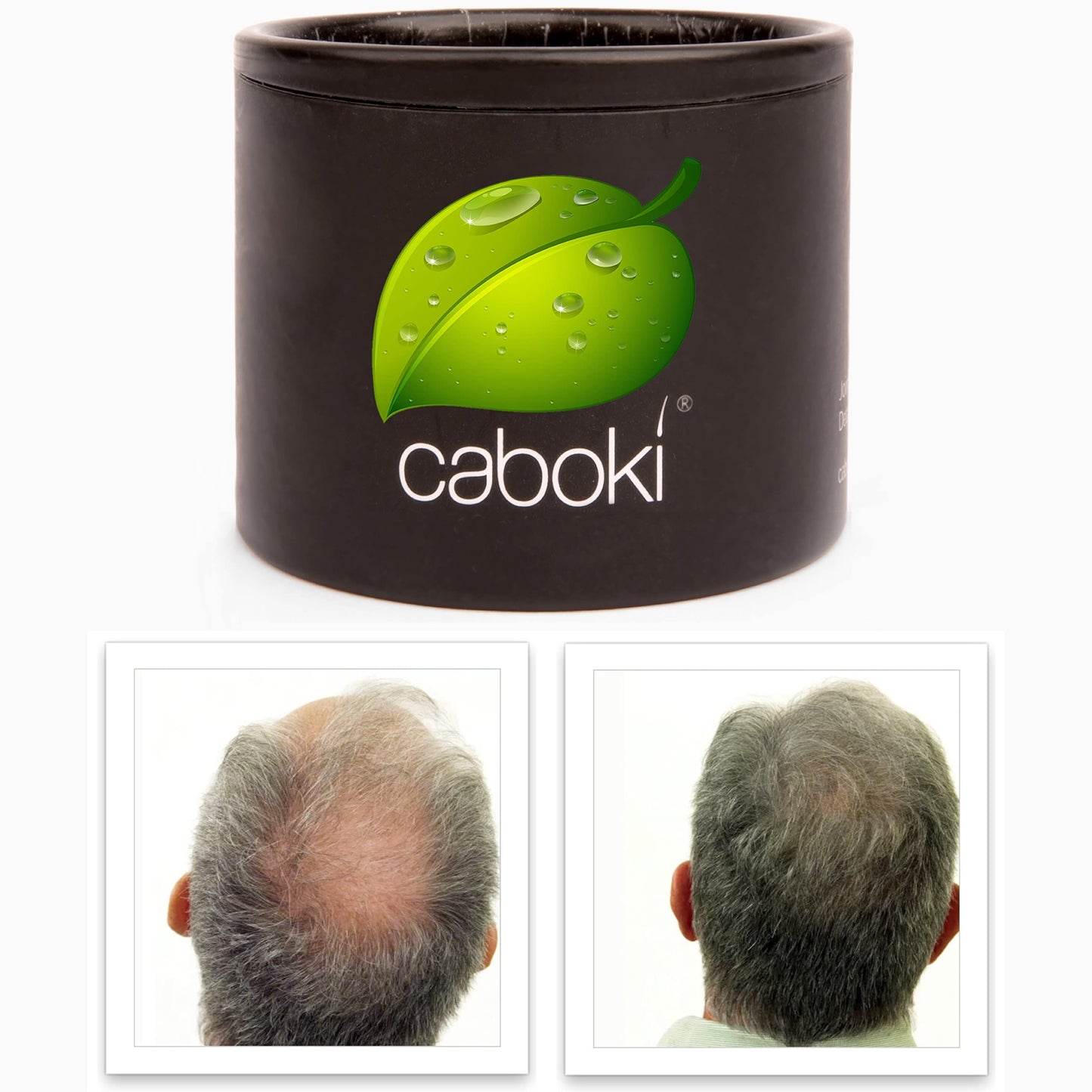 Hair Thickening Fibers. Cover Bald Spot and Thinning Hair Instantly. Make Thin Hair Look 10X Fuller. All-Natural Hair Building Fiber. Trial Size (10-Day Supply). Silver/White