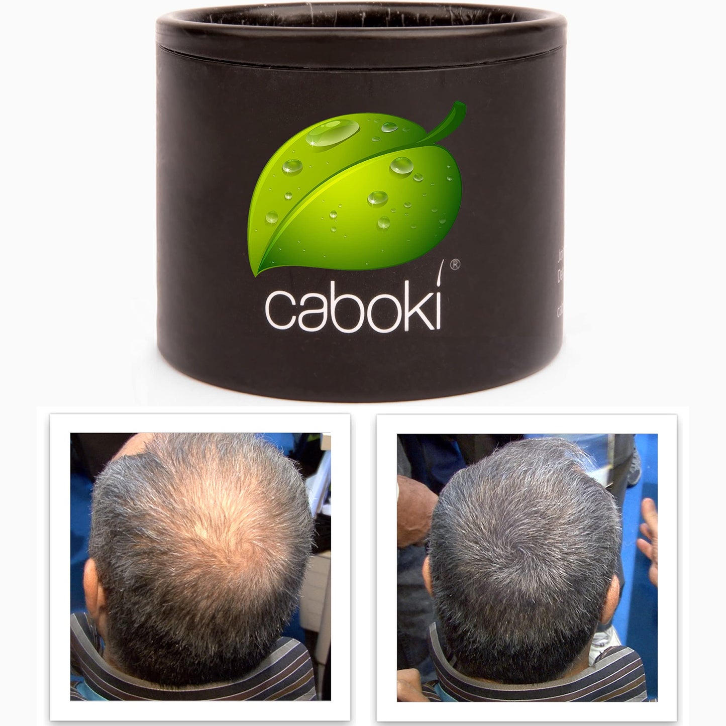 Hair Thickening Fibers. Cover Bald Spot and Thinning Hair Instantly. Make Thin Hair Look 10X Fuller. All-Natural Hair Building Fiber. Trial Size (10-Day Supply). Silver/White