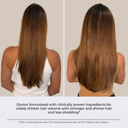 Thickening Hair Growth Serum Women & Men, Biotin Collagen & Rosemary Scalp Serum for Hair Density & Hydrating, Densifying Hair Serum Regrowth Oil for Hair Loss