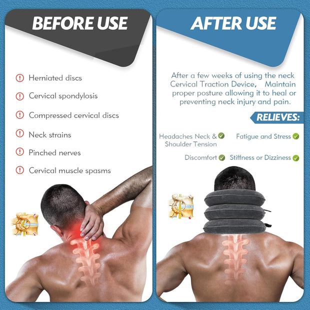 Neck Stretcher, Cervical Traction Device, Neck Traction Device, Neck Pain Relief, Adjustable Inflatable Neck Brace & Neck Stretcher Cervical Traction, Neck Decompression Home Use (Purple)