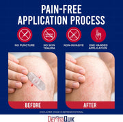 Laceration Kit - 2 Patented Laceration Closure Strips, Upgrade from Small Butterfly Bandages Wound Closure Strips, Breathable, Zip Stitchless Kit for Kids to Elderly - Home & Field Use