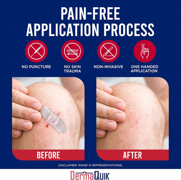 Laceration Kit - 2 Patented Laceration Closure Strips, Upgrade from Small Butterfly Bandages Wound Closure Strips, Breathable, Zip Stitchless Kit for Kids to Elderly - Home & Field Use