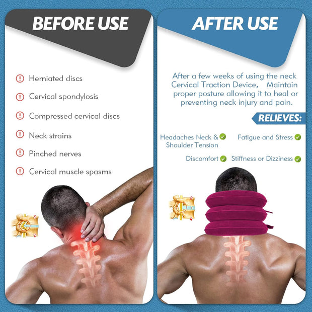Neck Stretcher, Cervical Traction Device, Neck Traction Device, Neck Pain Relief, Adjustable Inflatable Neck Brace & Neck Stretcher Cervical Traction, Neck Decompression Home Use (Purple)