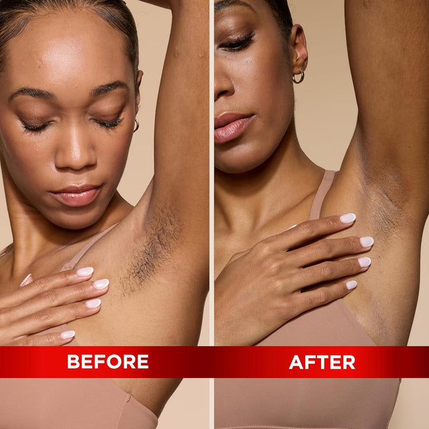 SoftSheen-Carson Magic Razorless Shaving Cream, Hair Removal Cream for Body Hair, Extra Strength Depilatory Cream, Works in 4 Minutes for Coarse Hair, 6 oz