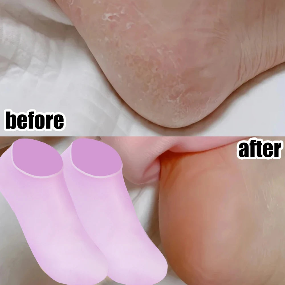 3colors Silicone Moisturizing Socks Exfoliating Gel Heel Socks Callus Cracked Dead Skin Remove Protector Pain Relief Foot Care