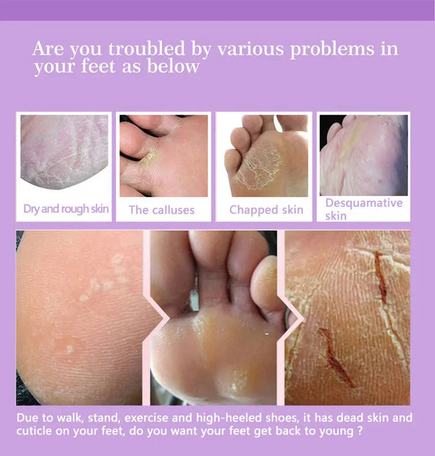 1-10Pcs Exfoliating Foot Mask Foot Spa Pedicure Socks Removing Dead Skin Whitening Heels Peeling Anti Cracked Foot Skin Care