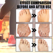Unisex Anti-Bunions Health Sock Hallux Valgus Correcting Sock Aching Bunion Relief Breathable Foot Care Sock