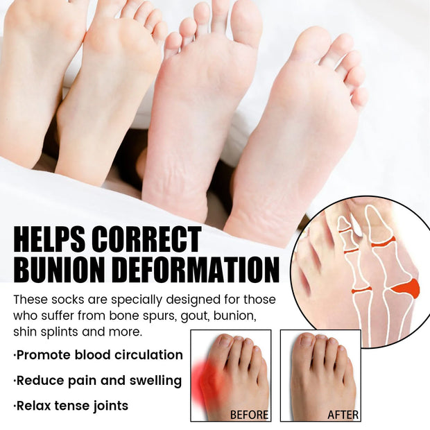 Unisex Anti-Bunions Health Sock Hallux Valgus Correcting Sock Aching Bunion Relief Breathable Foot Care Sock