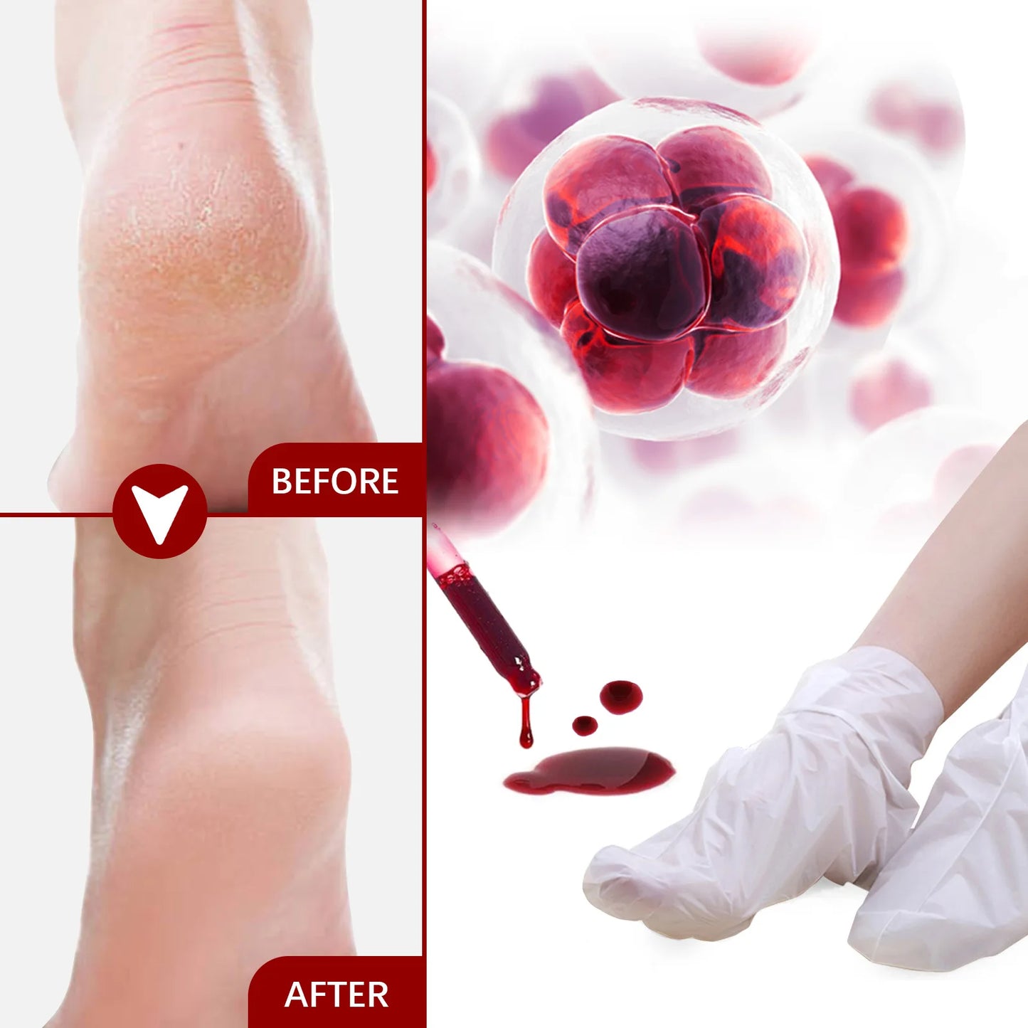 5/1Pair Feet Exfoliating Foot Masks Pedicure Socks Exfoliation Scrub for Feet Mask Pedicure Stone Foot Peeling Mask For Foot Spa