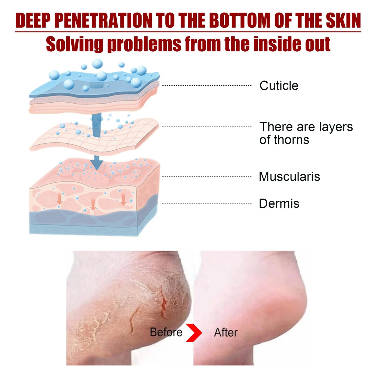 5/1Pair Feet Exfoliating Foot Masks Pedicure Socks Exfoliation Scrub for Feet Mask Pedicure Stone Foot Peeling Mask For Foot Spa